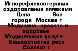 Иглорефлексотерапия, оздоровление пиявками › Цена ­ 3 000 - Все города, Москва г. Медицина, красота и здоровье » Медицинские услуги   . Башкортостан респ.,Салават г.